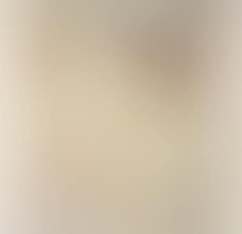Figure (preview)