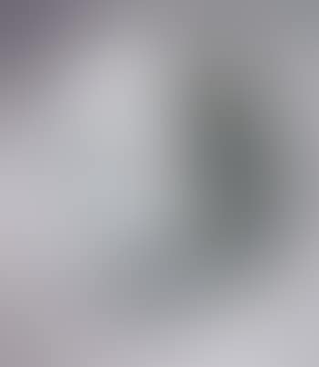 Amoeba (preview)