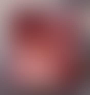 Harmas (preview)