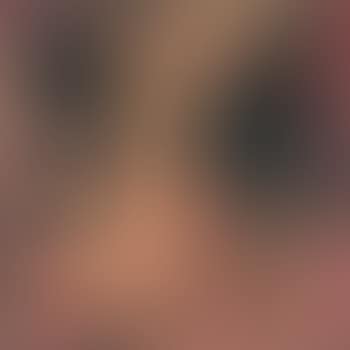 Verknotung im Flimmern (preview)