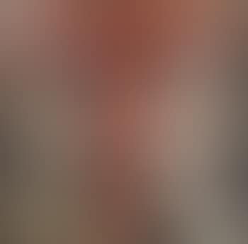Abstract (preview)