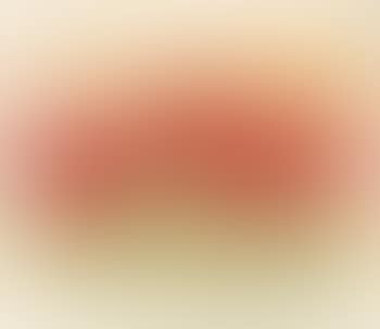 Rote Rosen (preview)