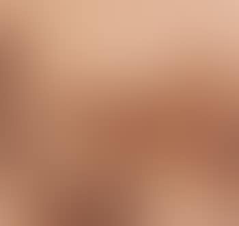 Volendam (preview)