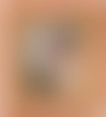 Vixon (preview)