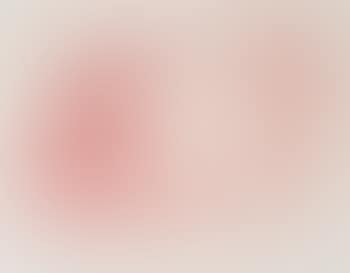 Det syke barn I (preview)