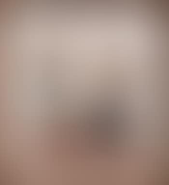 Due figure (preview)