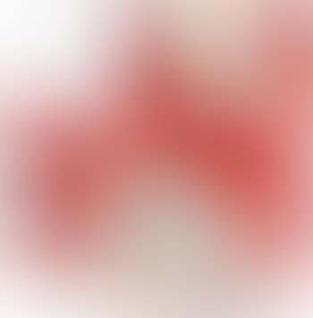 And Then, And Then And Then And Then And Then And Then. Red Dots (preview)