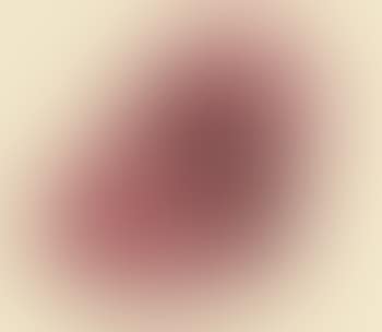 Study Mouth for Smoker (preview)