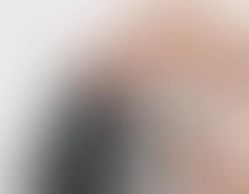 Fig 1: Opening the camera back (preview)