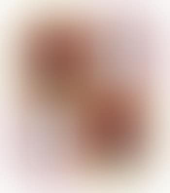Back (preview)