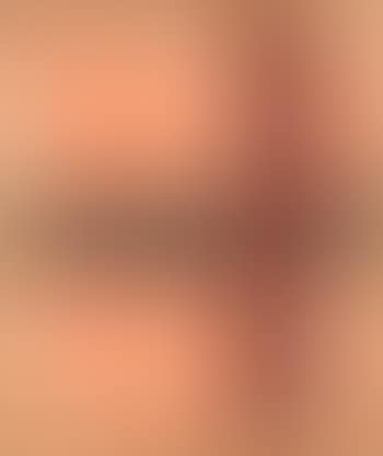O.T. (preview)