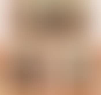 Selected Images (preview)