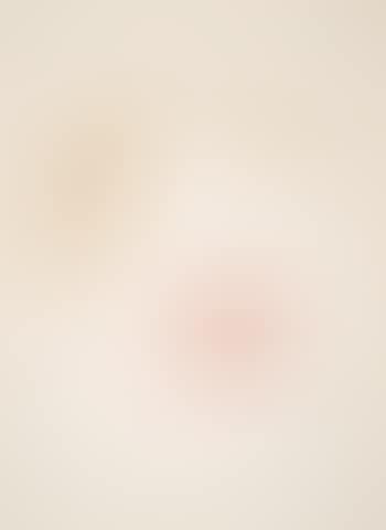 Transfiguration (preview)