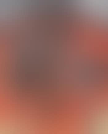 Opio (preview)