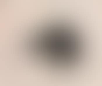 Creepo (The Dog) (preview)