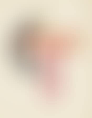 Figuration CT (preview)