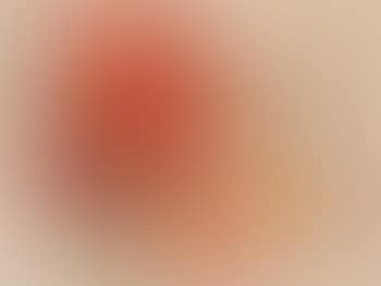 Albtraum (preview)