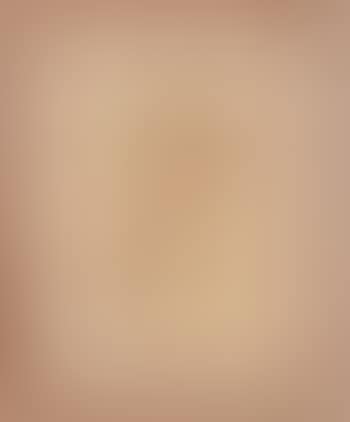 Figure (preview)