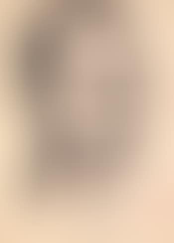 Figure (preview)