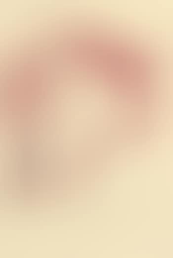 Untitled (Roter Kopf) (preview)
