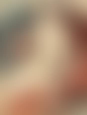 Akt (preview)