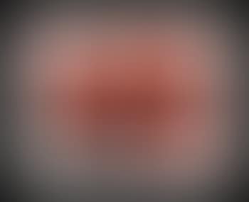 Watermelons (preview)