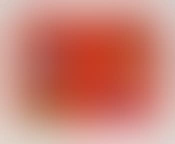 Bad finger (preview)