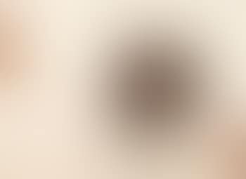 Sans titre (preview)