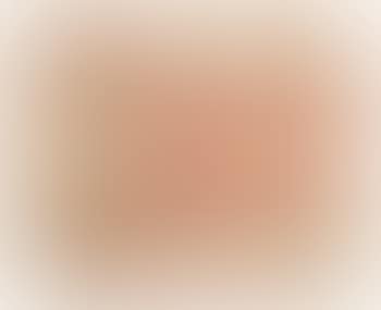 Stelle (preview)