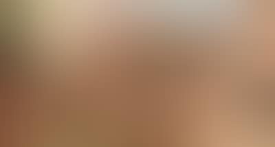 (Miskowitz (preview)