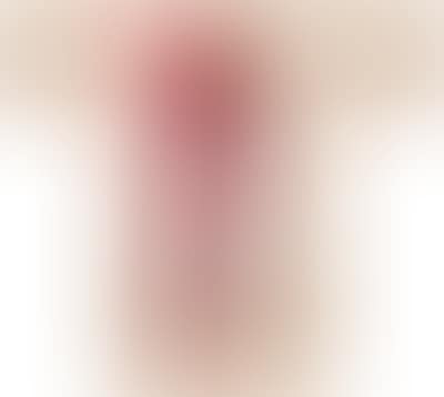 Surplice (preview)