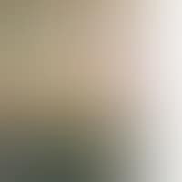 Watts Wall (preview)