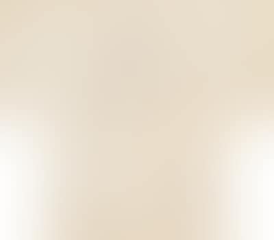 Untitled (set of five pieces) (preview)