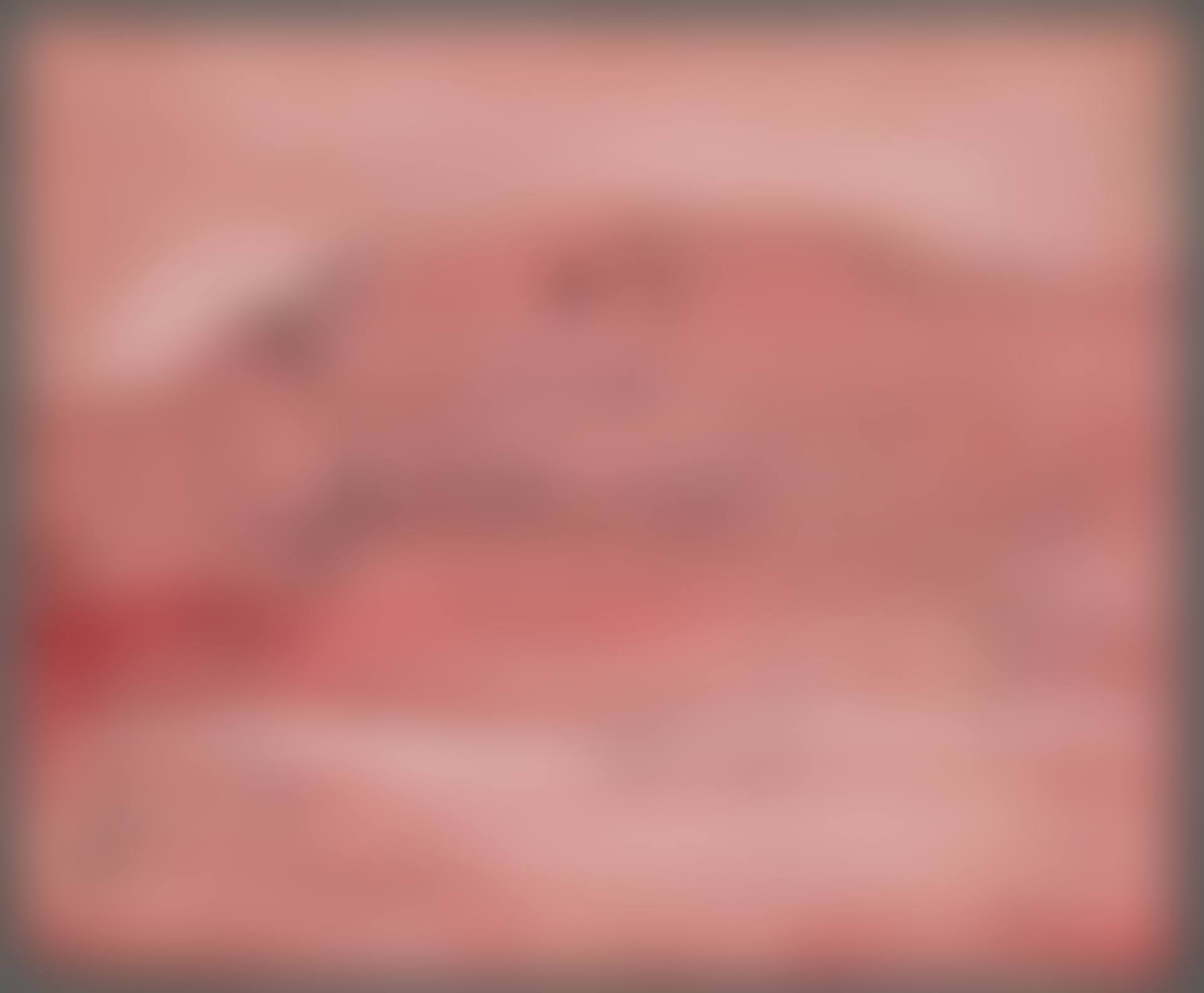 DX 304 (preview)