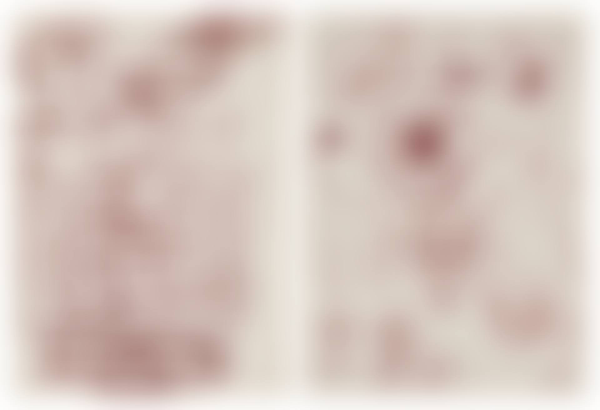Untitled (Psychoanalytic Series) [A Double-Sided Work] (preview)