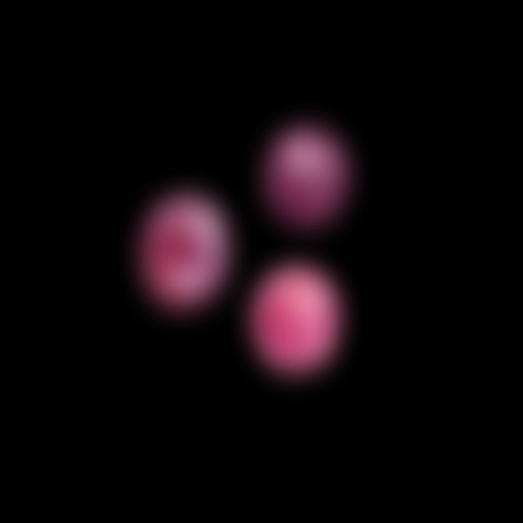 Three Rare Star Spinels (preview)