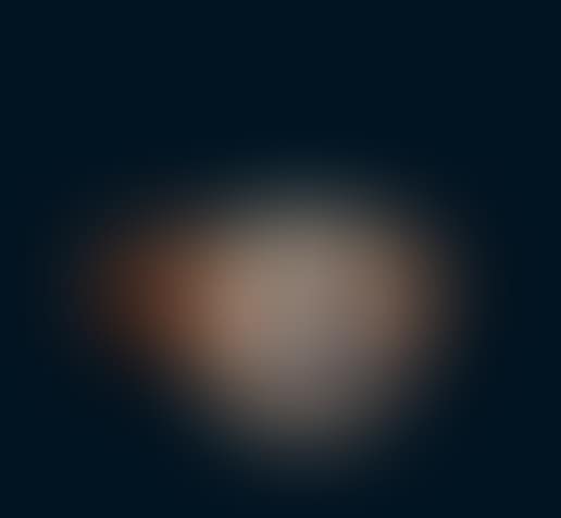 Ring (preview)