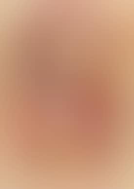 Untitled (Head) (preview)