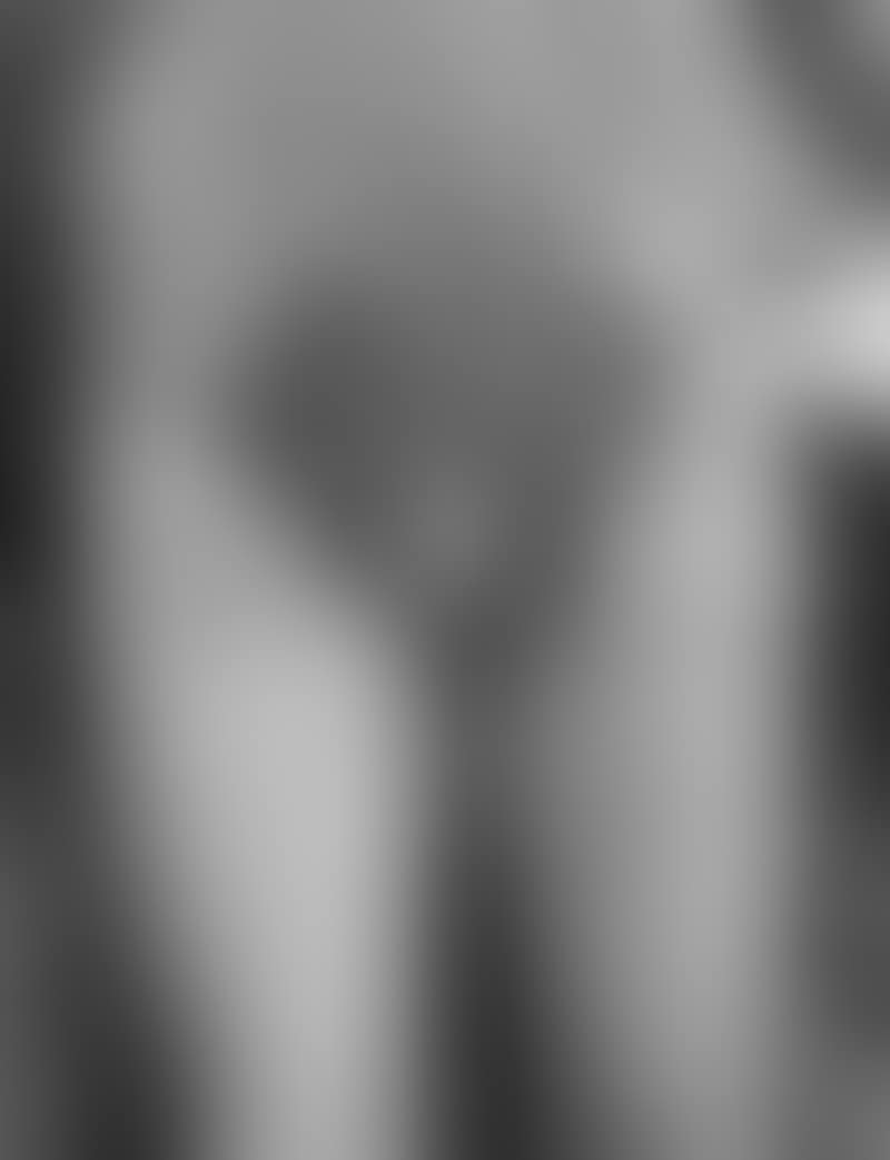 Aktion (preview)