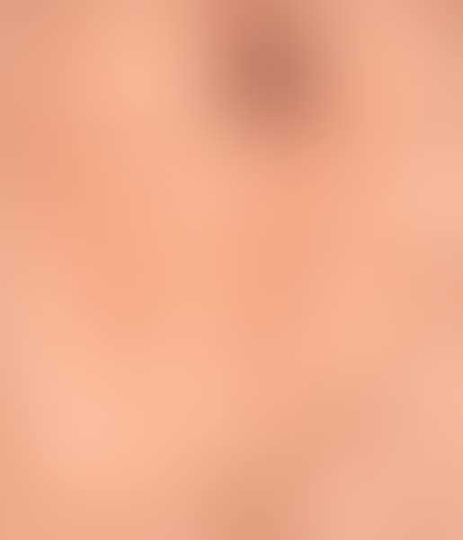 Echidna (preview)