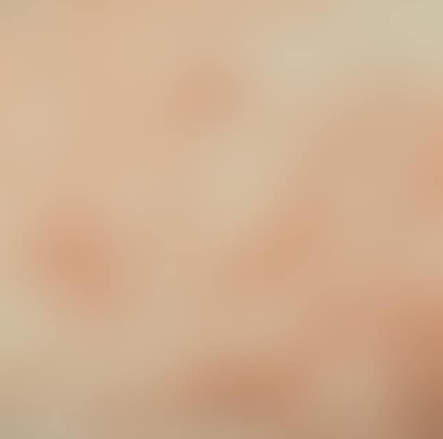 Diana and Endymion. (preview)