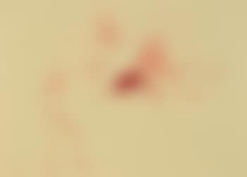 Untitled, from 'Spur I' (preview)