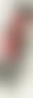 Longevity (preview)