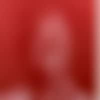 RED BLIND ONCLE N ° 2 (preview)