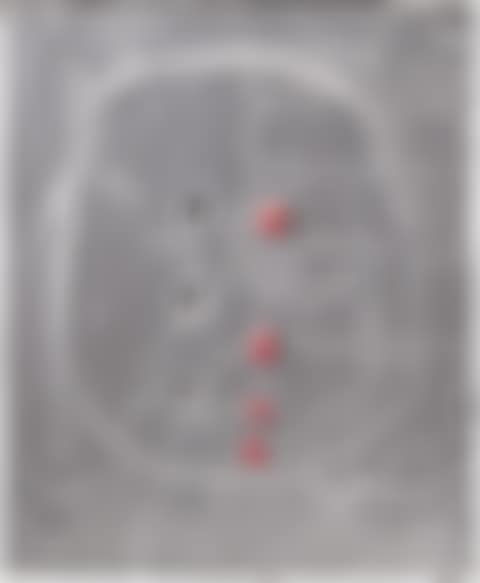 Concetto Spaziale (preview)