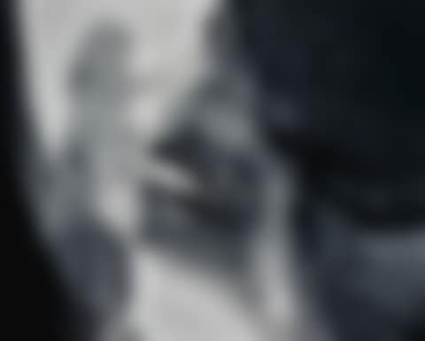 KISS 2 (preview)