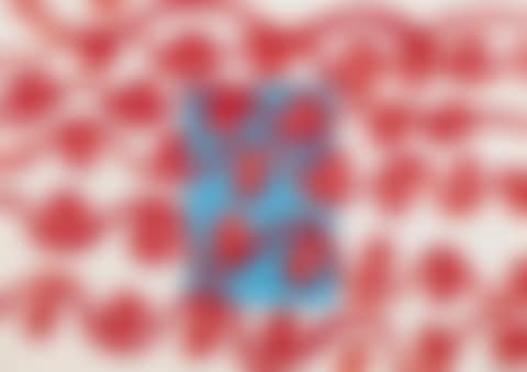 The Telephone Call from the Slammer (diptych), from What Is the Shape of This Problem? Series (preview)