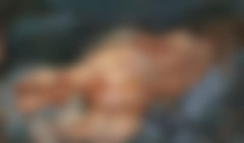 Resting (preview)