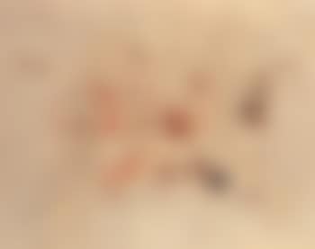 Untitled (preview)