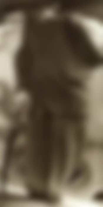 Carlo rim distortion (preview)